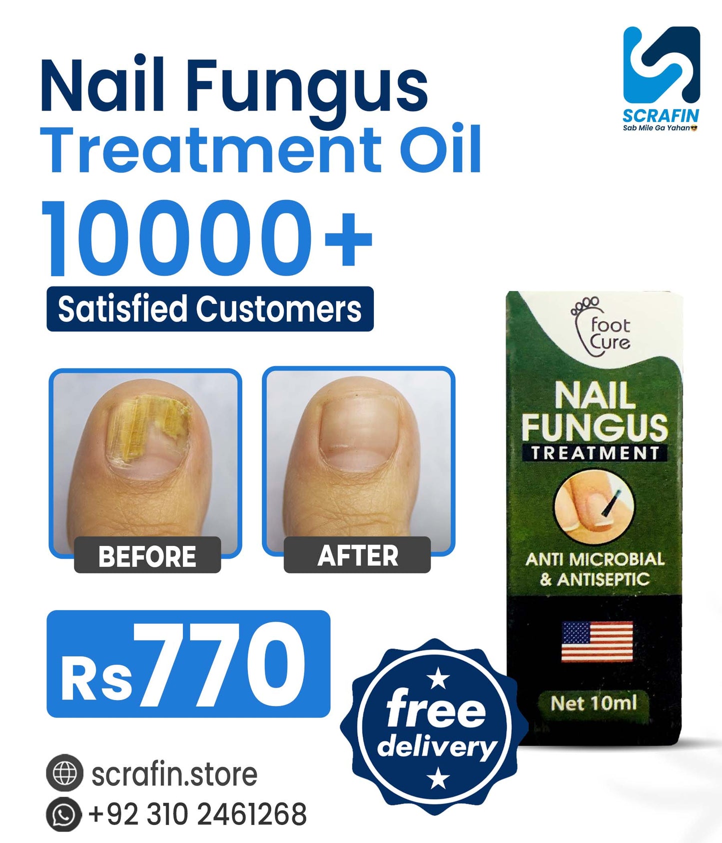 Nail Fungus Treatment Oil