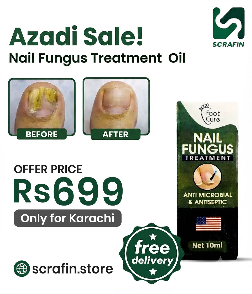NAIL FUNGUS OIL AZADI OFFER